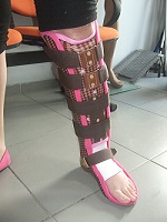 PTB (Patellar Tendon Brace)